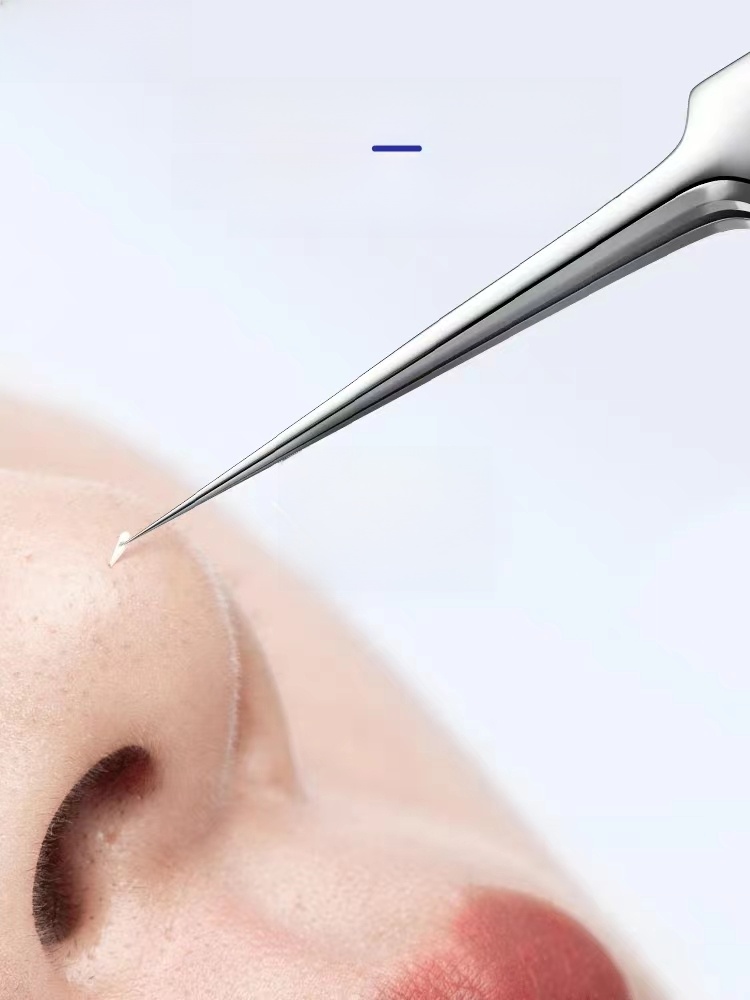 Ultra-Fine Blackhead Removing Tweezers Handy Gadget Scraping Closed Mouth Pimple Pin