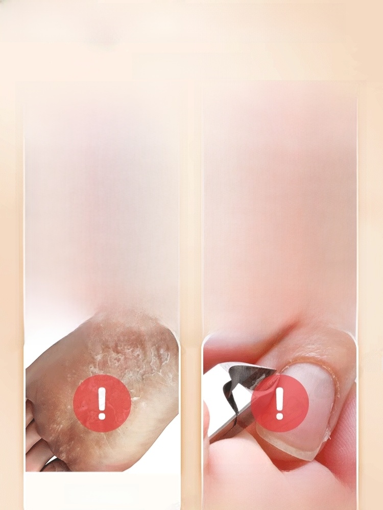 Adhesive Plaster Breathable High Viscosity Medical Tape