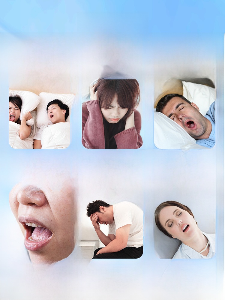 Beijing Liquid Eliminating Plaster Spray Severe Anti-Snoring Device